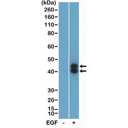Invitrogen Phospho-ERK1/2 (Thr202, Tyr204) Recombinant Rabbit Monoclonal