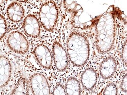 Invitrogen Phospho-JNK1/JNK2/JNK3 (Thr183, Tyr185) Recombinant Rabbit Monoclonal