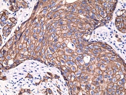Invitrogen&trade;&nbsp;ErbB2 (HER-2) Recombinant Rabbit Monoclonal Antibody (RM228)