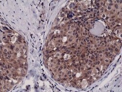 Invitrogen™ Caspase 3 Recombinant Rabbit Monoclonal Antibody (RM250)