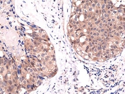 Invitrogen™ AKT1 Recombinant Rabbit Monoclonal Antibody (RM252)