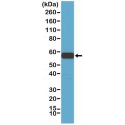 Invitrogen AKT1 Recombinant Rabbit Monoclonal Antibody (RM252) 100 &mu;L;