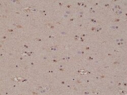 Invitrogen S100B Recombinant Rabbit Monoclonal Antibody (RM304) 100 &mu;L;
