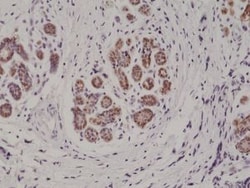 Invitrogen™ S100B Recombinant Rabbit Monoclonal Antibody (RM304)