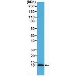 Invitrogen S100B Recombinant Rabbit Monoclonal Antibody (RM304) 100 &mu;L;