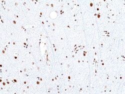 Invitrogen SMARCB1 Recombinant Rabbit Monoclonal Antibody (RM468) 100 &mu;L;