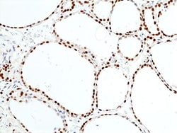Invitrogen™ SMARCB1 Recombinant Rabbit Monoclonal Antibody (RM468)