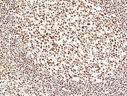 Invitrogen SMARCB1 Recombinant Rabbit Monoclonal Antibody (RM468) 100 &mu;L;