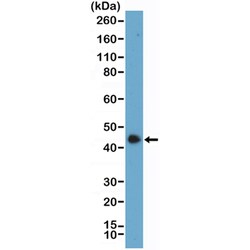 Invitrogen SMARCB1 Recombinant Rabbit Monoclonal Antibody (RM468) 100 &mu;L;