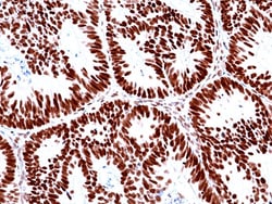 Invitrogen MSH2 Recombinant Rabbit Monoclonal Antibody (RM478) 100 &mu;L;