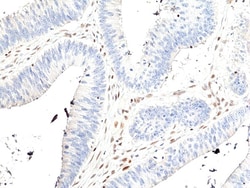 Invitrogen™ MSH2 Recombinant Rabbit Monoclonal Antibody (RM478)