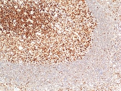 Invitrogen MSH2 Recombinant Rabbit Monoclonal Antibody (RM478) 100 &mu;L;