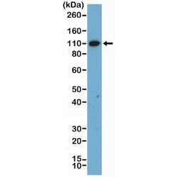 Invitrogen MSH2 Recombinant Rabbit Monoclonal Antibody (RM478) 100 &mu;L;