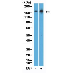 Invitrogen Phospho-EGFR (Tyr1068) Recombinant Rabbit Monoclonal Antibody (RM443) 100 &mu;L | Buy Online | Invitrogen&trade; | Fisher Scientific
