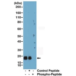 Invitrogen™ Phospho-MYL2 (Ser19) Recombinant Rabbit Monoclonal Antibody (RM484)
