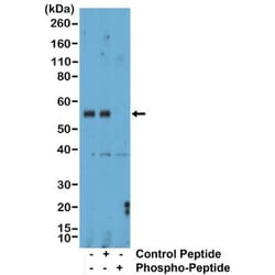 Invitrogen™ Phospho-SMAD1/SMAD5/SMAD9 (Ser463, Ser465, Ser467) Recombinant Rabbit Monoclonal Antibody (RM487)
