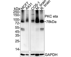 Invitrogen PKC eta Recombinant Rabbit Monoclonal Antibody (JE32-41) 100