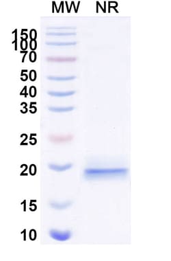 Invitrogen&trade;&nbsp;VWF VHH-8His-Cys-tag Recombinant Alpaca Monoclonal Antibody (KB-VWF-D3.1)