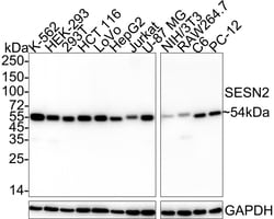 Invitrogen&trade;&nbsp;SESN2 Recombinant Rabbit Monoclonal Antibody (PSH05-78)
