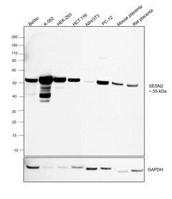 Invitrogen&trade;&nbsp;SESN2 Recombinant Rabbit Monoclonal Antibody (PSH05-78)
