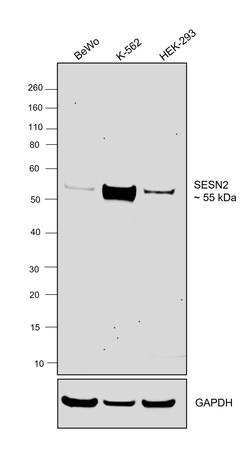 Invitrogen&trade;&nbsp;SESN2 Recombinant Rabbit Monoclonal Antibody (PSH05-78)