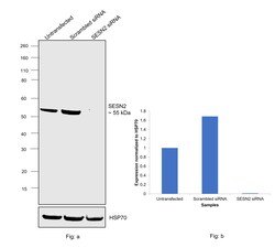 Invitrogen&trade;&nbsp;SESN2 Recombinant Rabbit Monoclonal Antibody (PSH05-78)
