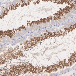 Invitrogen LKB1 Recombinant Rabbit Monoclonal Antibody (PSH09-29) 100 &mu;L;