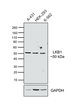 Invitrogen LKB1 Recombinant Rabbit Monoclonal Antibody (PSH09-29) 100 &mu;L;