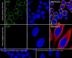 Invitrogen&trade;&nbsp;LCK Recombinant Rabbit Monoclonal Antibody (PSH09-25)
