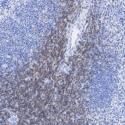 Invitrogen&trade;&nbsp;LCK Recombinant Rabbit Monoclonal Antibody (PSH09-25)