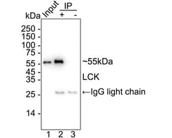 Invitrogen&trade;&nbsp;LCK Recombinant Rabbit Monoclonal Antibody (PSH09-25)