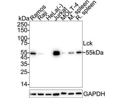 Invitrogen&trade;&nbsp;LCK Recombinant Rabbit Monoclonal Antibody (PSH09-25)