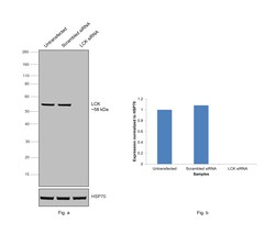 Invitrogen&trade;&nbsp;LCK Recombinant Rabbit Monoclonal Antibody (PSH09-25)