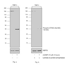 Invitrogen&trade;&nbsp;Phospho-STING (Ser366) Recombinant Rabbit Monoclonal Antibody (PSH09-72)