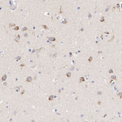 Invitrogen&trade;&nbsp;TRPML1 Recombinant Rabbit Monoclonal Antibody (PSH09-01)