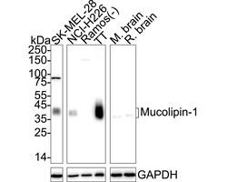 Invitrogen&trade;&nbsp;TRPML1 Recombinant Rabbit Monoclonal Antibody (PSH09-01)