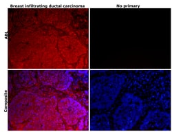 Invitrogen&trade;&nbsp;c-Abl Recombinant Rabbit Monoclonal Antibody (PSH04-08)