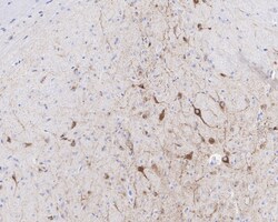 Invitrogen DLK1 Recombinant Rabbit Monoclonal Antibody (PSH04-76) 100 &mu;L | Buy Online | Invitrogen&trade; | Fisher Scientific
