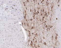 Invitrogen DLK1 Recombinant Rabbit Monoclonal Antibody (PSH04-76) 100 &mu;L | Buy Online | Invitrogen&trade; | Fisher Scientific
