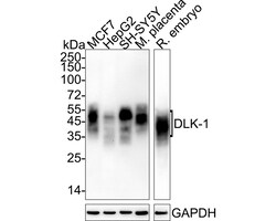 Invitrogen DLK1 Recombinant Rabbit Monoclonal Antibody (PSH04-76) 100 &mu;L | Buy Online | Invitrogen&trade; | Fisher Scientific