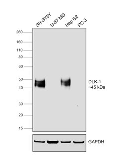 Invitrogen DLK1 Recombinant Rabbit Monoclonal Antibody (PSH04-76) 100 &mu;L | Buy Online | Invitrogen&trade; | Fisher Scientific