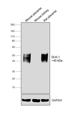 Invitrogen DLK1 Recombinant Rabbit Monoclonal Antibody (PSH04-76) 100 &mu;L | Buy Online | Invitrogen&trade; | Fisher Scientific