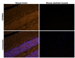 Invitrogen&trade;&nbsp;TGFBR1 Recombinant Rabbit Monoclonal Antibody (PSH14-14)