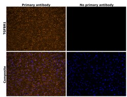 Invitrogen TGFBR1 Recombinant Rabbit Monoclonal Antibody (PSH14-14) 100 &mu;L | Buy Online | Invitrogen&trade; | Fisher Scientific
