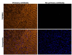 Invitrogen TGFBR1 Recombinant Rabbit Monoclonal Antibody (PSH14-14) 100 &mu;L | Buy Online | Invitrogen&trade; | Fisher Scientific
