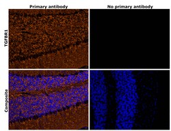 Invitrogen TGFBR1 Recombinant Rabbit Monoclonal Antibody (PSH14-14) 100 &mu;L | Buy Online | Invitrogen&trade; | Fisher Scientific