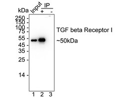 Invitrogen TGFBR1 Recombinant Rabbit Monoclonal Antibody (PSH14-14) 100 &mu;L | Buy Online | Invitrogen&trade; | Fisher Scientific