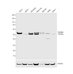 Invitrogen TGFBR1 Recombinant Rabbit Monoclonal Antibody (PSH14-14) 100 &mu;L | Buy Online | Invitrogen&trade; | Fisher Scientific