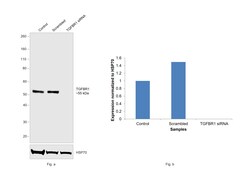 Invitrogen TGFBR1 Recombinant Rabbit Monoclonal Antibody (PSH14-14) 100 &mu;L | Buy Online | Invitrogen&trade; | Fisher Scientific