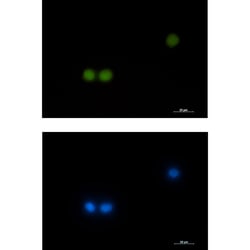 Invitrogen HOXB4 Recombinant Rabbit Monoclonal Antibody (K01_1S45) 100 &mu;L | Buy Online | Invitrogen&trade; | Fisher Scientific